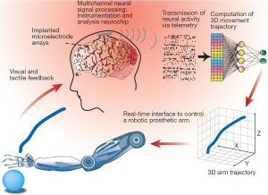 neurochip