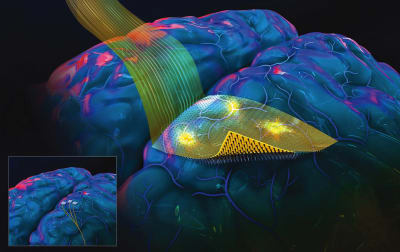 neurochip